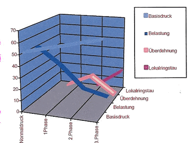 Diagramm: Entwicklung von Lokalringstau über die Druckphasen
