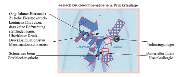 Druckkontinenzebenen im Unterleib und ihre Beschwerdebilder