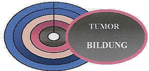 Ringschema der Tumorbildung durch Druckstau